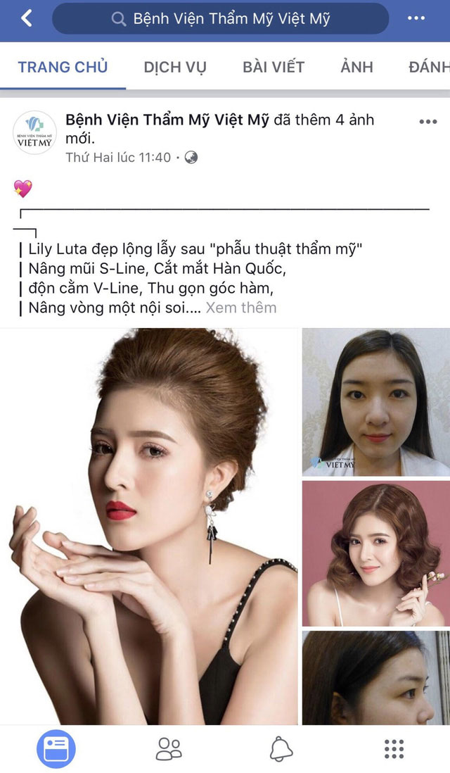 lily luta hút mỡ bụng