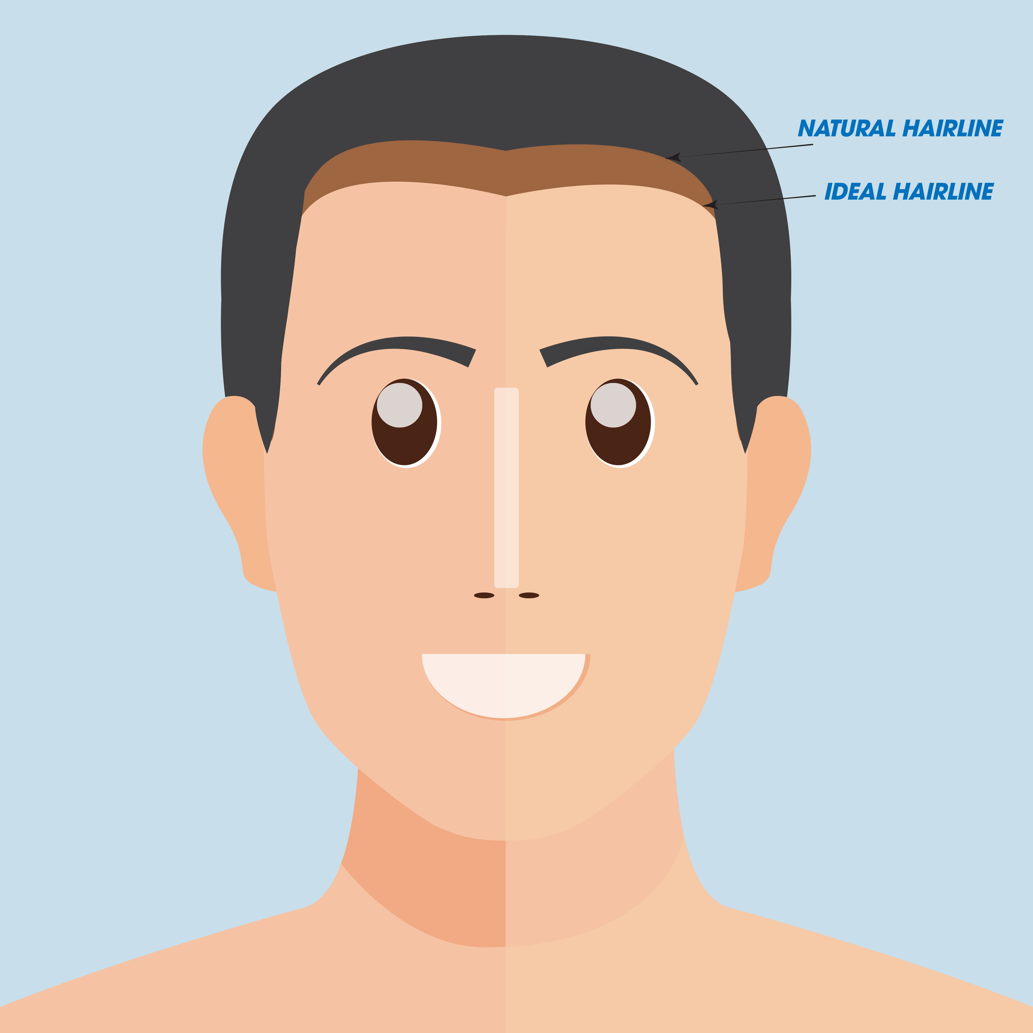 đường chân tóc