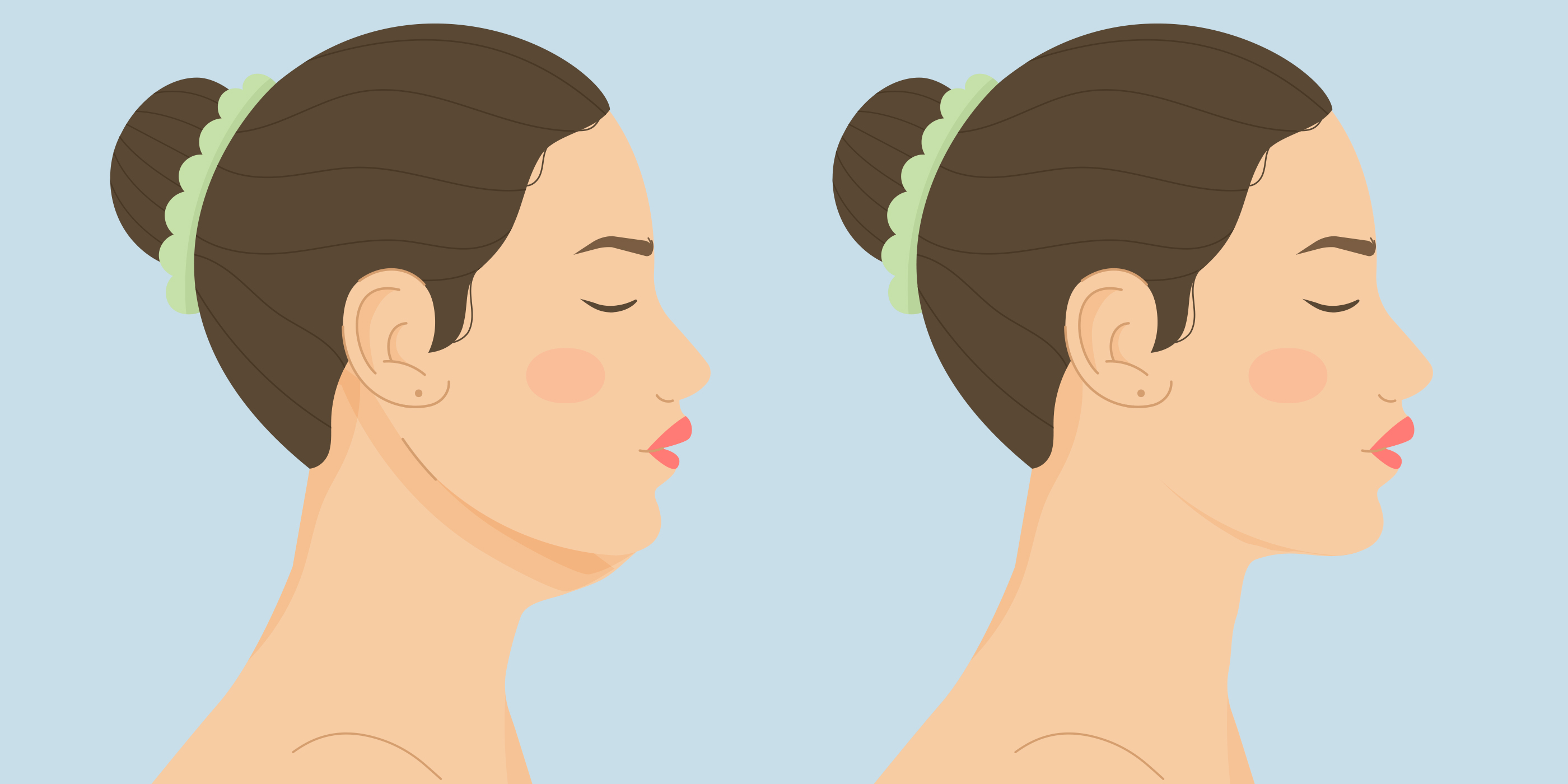 Góc cằm hàm lý tưởng của người trẻ ở quanh 95 độ