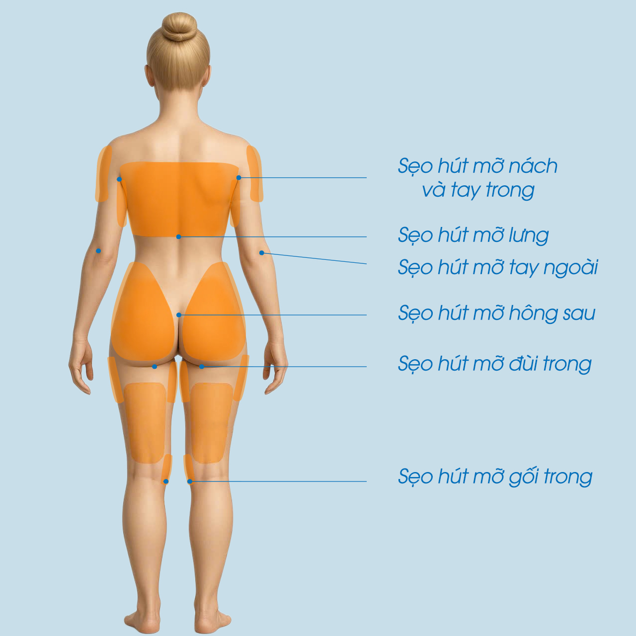 mô phỏng hút mỡ đùi, bụng, tay, nách